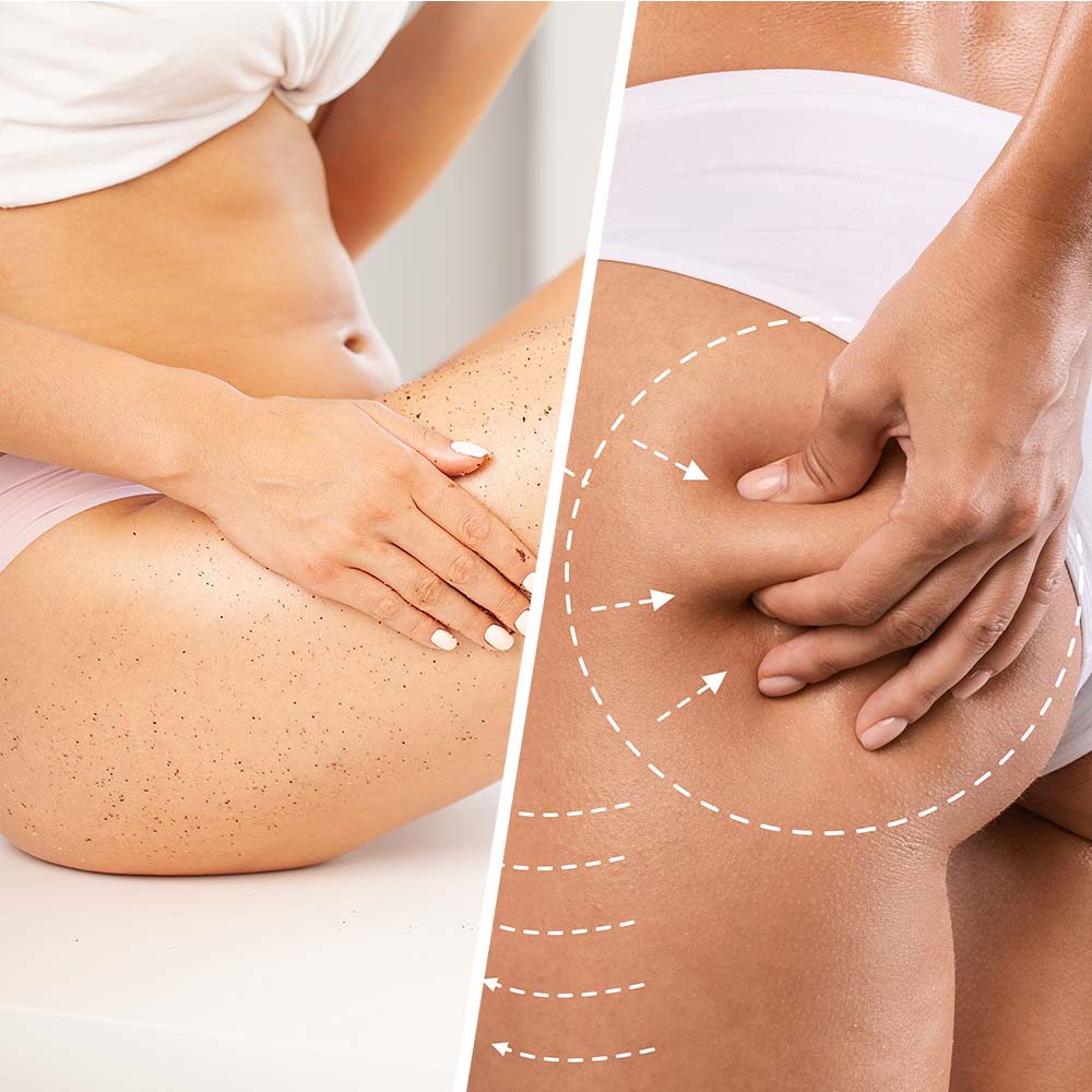 NIACIN CELLULITE SCRUB Extra-Firming Organic Coconut Sugar & Talasso Body Exfoliator